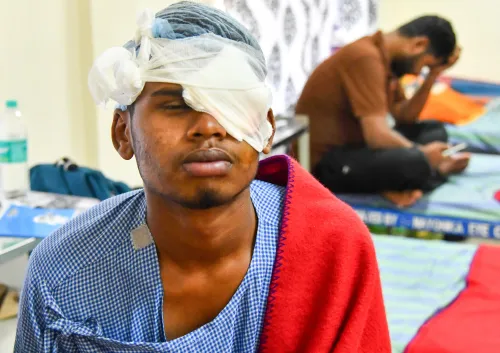 Why Did 190 People Suffer Eye Injuries from Firecrackers and Carbide Guns During Diwali?