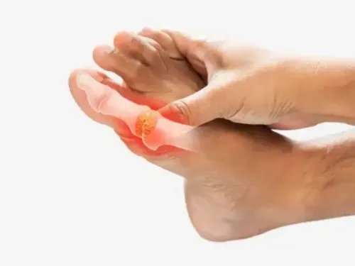 क्या 'आम' है गठिया की मुख्य वजह? जानें आयुर्वेद से बचाव के उपाय