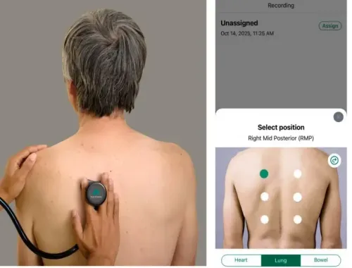Can AI-powered digital stethoscopes bridge screening gaps?