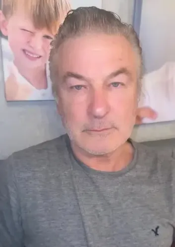 Alec Baldwin's Son, Leo, Experiences Forehead Injury on Family Vacation