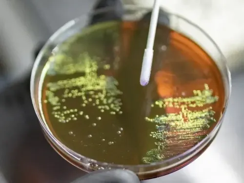 Are Amoebae in Mumbai Creek Harbouring Bacteria with High AMR Risk?