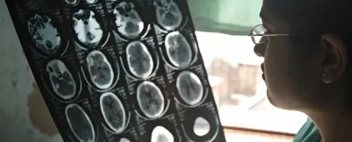 क्या दुनिया का हर 3 में से 1 व्यक्ति मस्तिष्क विकार से प्रभावित है? प्रतिवर्ष 11 मिलियन लोगों की होती है मौत: रिपोर्ट