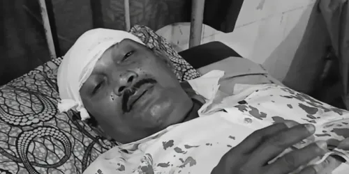 पश्चिम बंगाल चुनाव 2026: टीएमसी पर हमले का आरोप, भाजपा पोलिंग एजेंट बोले — 'सिर पर रॉड से मारा'