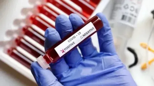 Has K'taka Health Ministry Noticed a Surge in Covid Cases in Bengaluru?