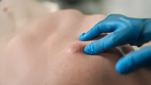 क्या शरीर में बनने वाली हर गांठ खतरनाक होती है? आयुर्वेद से अर्बुद और ग्रन्थि की भिन्नता जानें