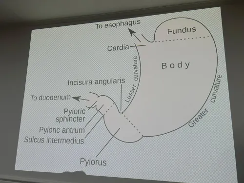 Can Metabolic Surgery Prevent Organ Damage From Uncontrolled Diabetes?