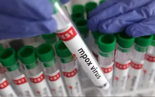 Are More Mpox Cases Emerging in Malawi with Lilongwe Leading the Count?