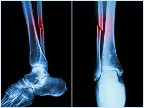 Can a New Machine Algorithm Identify Heart and Fracture Risks from Routine Bone Scans?