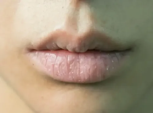 होंठ, झुर्रियों और अन्य समस्याओं के लिए वैसलीन का सही उपयोग कैसे करें?