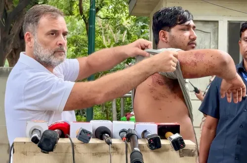 Rahul Gandhi accuses Centre of lying on pellet use in CJP protest