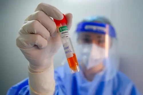 What Are the Latest COVID-19 Figures in Romania?