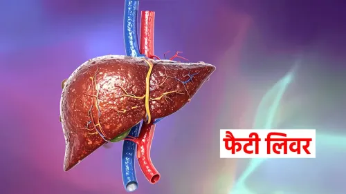 क्या एसजीपीजीआई में 'फैटी लिवर और मोटापा क्लिनिक' जल्द शुरू होगा?