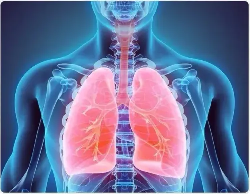 Research Reveals 1 in 3,000 Individuals at Risk of Pneumothorax Due to Genetic Mutation