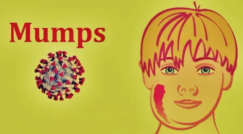 Tamil Nadu Raises Alarm as Mumps Cases Surge Among Schoolchildren in Coimbatore