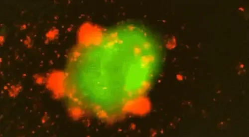 Ultrasound-Activated CAR T-Cell Therapy for Extended Tumor Elimination