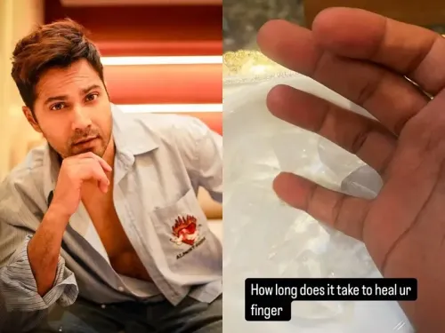 Varun Dhawan suffers a ‘work injury’, inquires about healing time