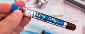 Research Uncovers Mechanism of Zika Virus in Human Placenta and Its Link to Foetal Demise