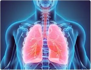 Research Reveals 1 in 3,000 Individuals at Risk of Pneumothorax Due to Genetic Mutation