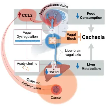 Study identifies reasons behind deadly weight loss in cancer patients