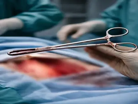 How Was a Surgical Forceps Left Inside a Kerala Woman for Five Years?