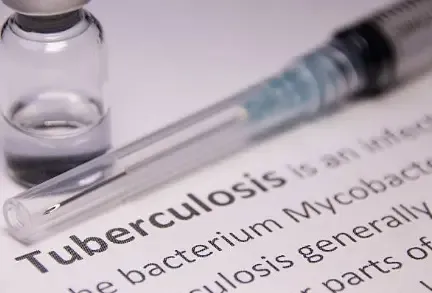 Tanzania Achieves 40% Decrease in New TB Cases Over Eight Years