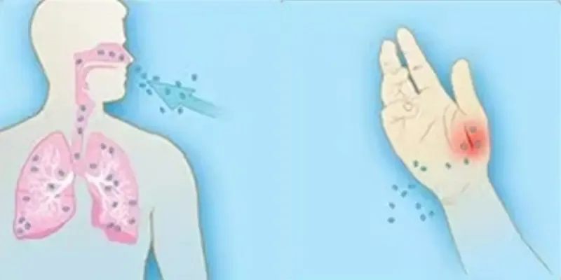 Did Thailand Confirm an Anthrax Death in a 53-Year-Old After Eating Raw Meat?