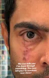 Abhishek Banerjee's 'scar' Instagram post stirs political buzz during US eye treatment