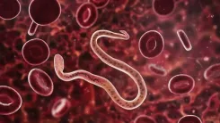 गैस बनना: स्वास्थ्य का संकेत, इंटेस्टाइनल वर्म इन्फेक्शन को न करें अनदेखा