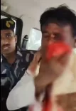 Was BJP MP Khagen Murmu Brutally Attacked in North Bengal?