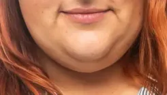 चेहरे की खूबसूरती पर भारी पड़ रही है डबल चिन, जानें योग से कैसे पा सकते हैं छुटकारा