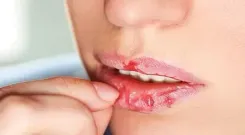 फटे होंठ और डबल चिन से हैं परेशान? ये एक्सरसाइज हैं कारगर