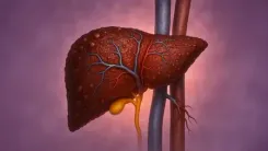 फैटी लिवर चुपचाप शरीर को पहुंचाता है नुकसान! आयुर्वेद से जानें बचाव के उपाय