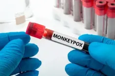 Is the New Mpox Variant Now in the Netherlands?