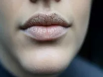 गर्मियों में रात को बार-बार प्यास लगना: आयुर्वेद बताता है वात-पित्त असंतुलन का संकेत