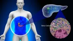 आईआईटी बॉम्बे की रिसर्च में खुलासा, शरीर में मौजूद कॉलेजन प्रोटीन से बढ़ रहा डायबिटीज का खतरा