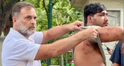 राहुल गांधी ने पेलेट से घायल साहिल को पेश कर केंद्र पर लगाया झूठ का आरोप, शिक्षा मंत्री की बर्खास्तगी की मांग
