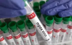 युगांडा में एमपॉक्स से संक्रमित के मामले 8000 के पार, 50 मौतें दर्ज 