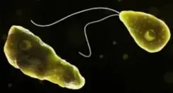 केरल में 11 साल की बच्ची को अमीबिक मेनिन्जाइटिस, मामले बढ़कर तीन हुए 