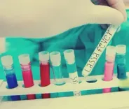 Lassa fever death toll in Nigeria rises to 172