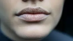 क्या मुंह सूखना सिर्फ डिहाइड्रेशन नहीं, गंभीर रोगों का संकेत भी है? आयुर्वेद से जानें समाधान