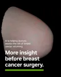 Nvidia-Powered AI Tool Helps Predict Breast Cancer Return