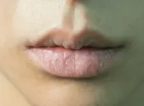 होंठ, झुर्रियों और अन्य समस्याओं के लिए वैसलीन का सही उपयोग कैसे करें?