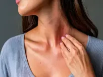 पित्ती: मौसम के बदलते ही शीतपित्त की समस्या करने लगती है परेशान, आयुर्वेद में लिखे हैं समाधान