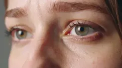 Preventable corneal blindness rising among teenagers, youth: Experts