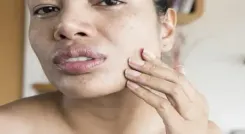  सर्दियों में ये चार चीजें देंगी रूखी त्वचा से निजात और फेस करेगा ग्लो