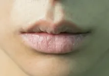 क्या सर्दियों में होंठों की नमी बनाए रखने के लिए घरेलू उपायों को अपनाना सही है?