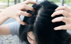 क्या सर्दियों में सिर की खुजली आपको परेशान कर रही है? अपनाएं ये आसान उपाय