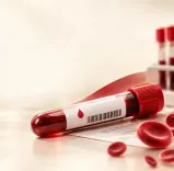 हीमोग्लोबिन रिपोर्ट कैसे पढ़ें: बच्चों, महिलाओं और पुरुषों के लिए एनीमिया के स्तर की पूरी जानकारी