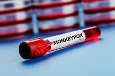 Has Spain Confirmed the First Human Transmission of Mpox Clade 1b Outside Africa?