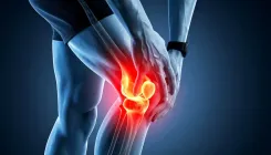 Could Rheumatoid Arthritis Actually Begin Years Before Symptoms Emerge?